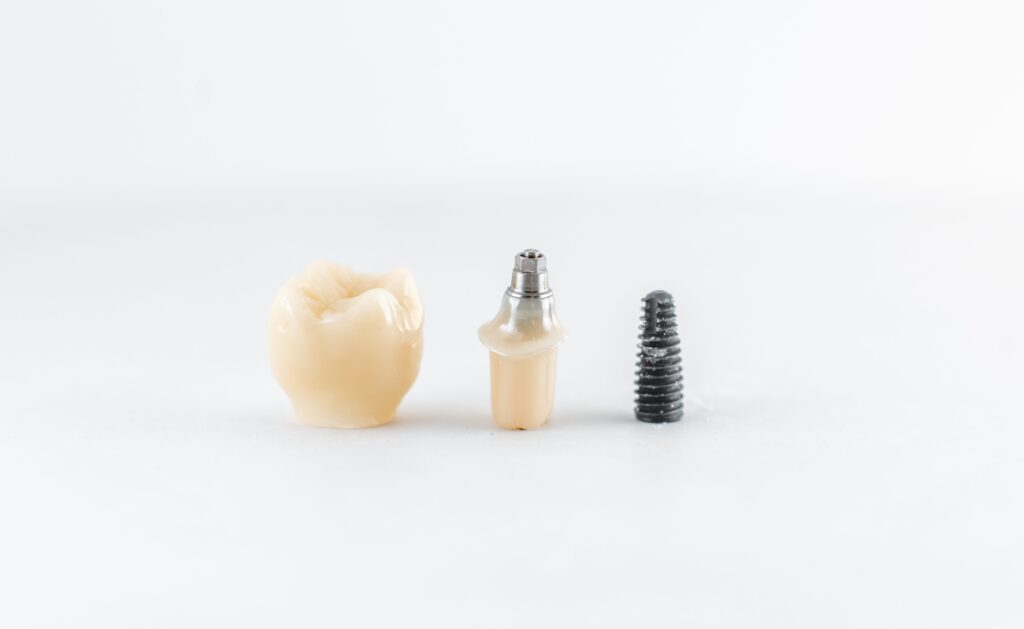 What are dental implants?